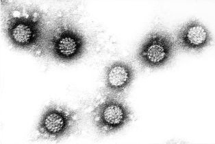 Cilvēka papilomas vīruss